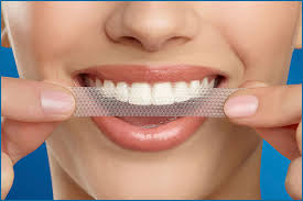Teeth Whitening Strips Purple Close-Fit Adhesion Enamel Safe For Lasting Bright Smile